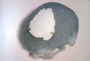 Biomodelação 3D